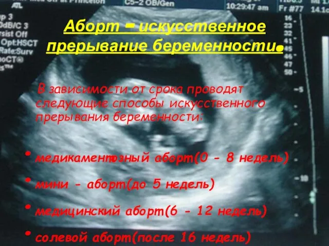 Аборт – искусственное прерывание беременности. В зависимости от срока проводят следующие способы