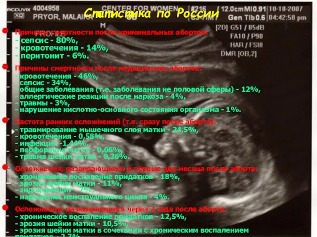 Статистика по России Причины смертности после криминальных абортов: - сепсис - 80%,