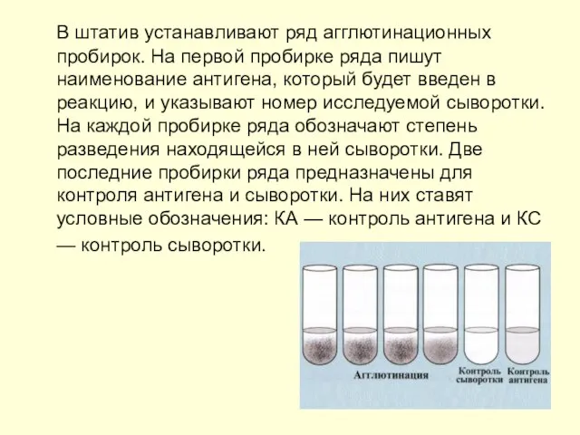 В штатив устанавливают ряд агглютинационных пробирок. На первой пробирке ряда пишут наименование