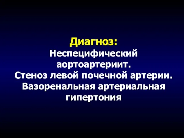 Диагноз: Неспецифический аортоартериит. Стеноз левой почечной артерии. Вазоренальная артериальная гипертония