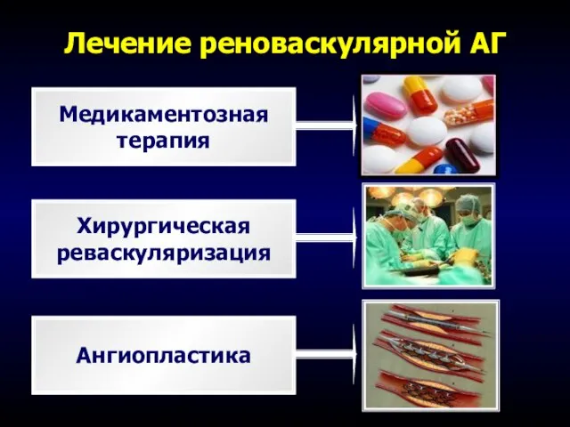 Лечение реноваскулярной АГ Медикаментозная терапия Хирургическая реваскуляризация Ангиопластика