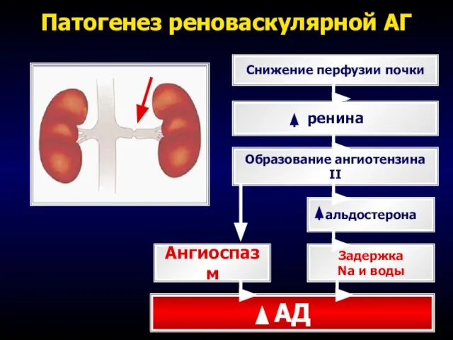 Патогенез реноваскулярной АГ Снижение перфузии почки ренина Образование ангиотензина II Ангиоспазм альдостерона