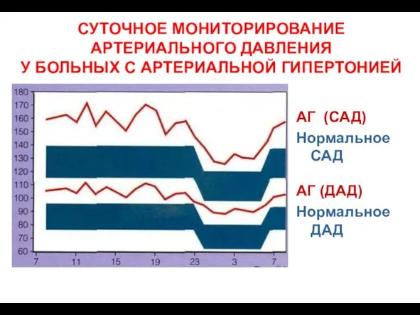 СУТОЧНОЕ МОНИТОРИРОВАНИЕ АРТЕРИАЛЬНОГО ДАВЛЕНИЯ У БОЛЬНЫХ С АРТЕРИАЛЬНОЙ ГИПЕРТОНИЕЙ АГ (САД) Нормальное