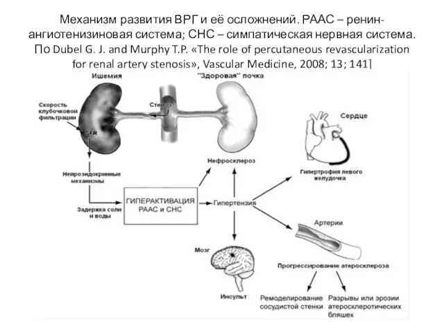 Механизм развития ВРГ и её осложнений. РААС – ренин-ангиотенизиновая система; СНС –