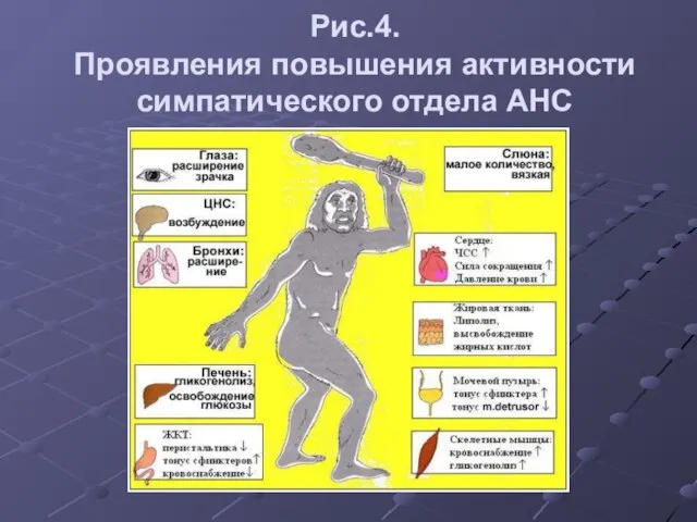 Рис.4. Проявления повышения активности симпатического отдела АНС