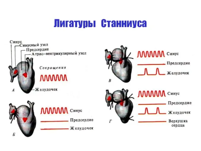 Лигатуры Станниуса