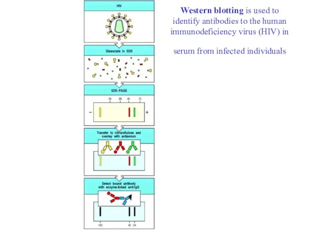 Western blotting is used to identify antibodies to the human immunodeficiency virus