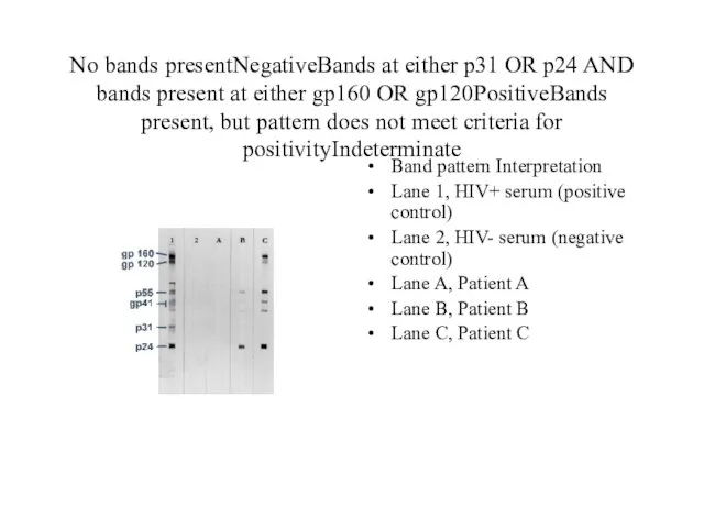 No bands presentNegativeBands at either p31 OR p24 AND bands present at