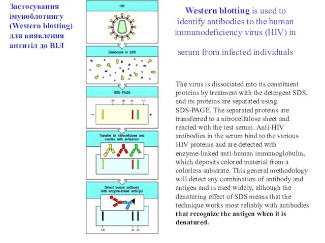 Western blotting is used to identify antibodies to the human immunodeficiency virus