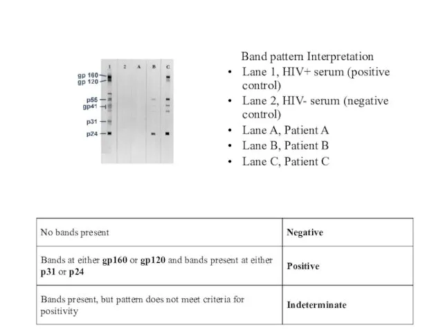 Band pattern Interpretation Lane 1, HIV+ serum (positive control) Lane 2, HIV-