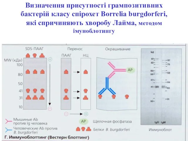 Визначення присутності грампозитивних бактерій класу спірохет Borrelia burgdorferi, які спричиняють хворобу Лайма, методом імуноблотингу