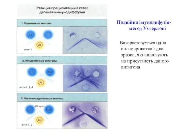 Подвійна імунодифузія-метод Ухтерлоні Використовується одна антисироватка і два зразка, які аналізують на присутність даного антигена