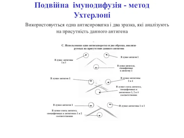 Подвійна імунодифузія - метод Ухтерлоні Використовується одна антисироватка і два зразка, які