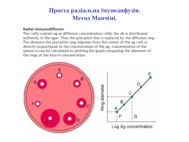 Проста радіальна імунодифузія. Метод Манчіні.