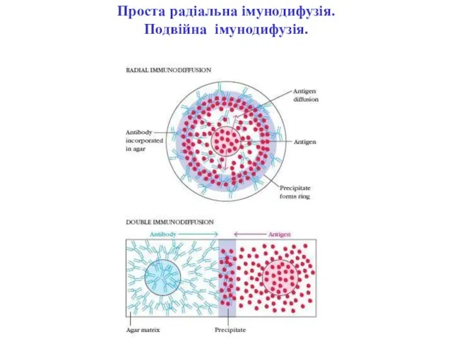 Проста радіальна імунодифузія. Подвійна імунодифузія.