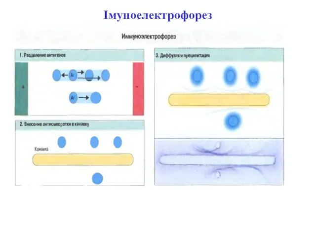 Імуноелектрофорез