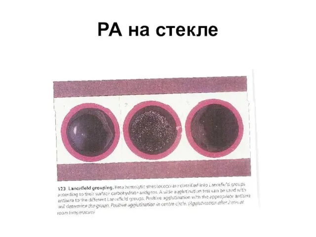 РА на стекле