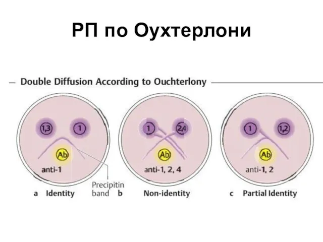 РП по Оухтерлони