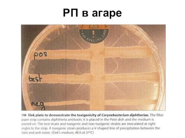 РП в агаре