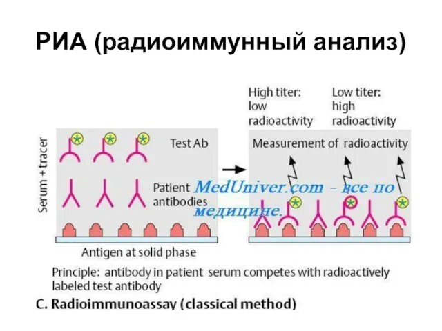 РИА (радиоиммунный анализ)