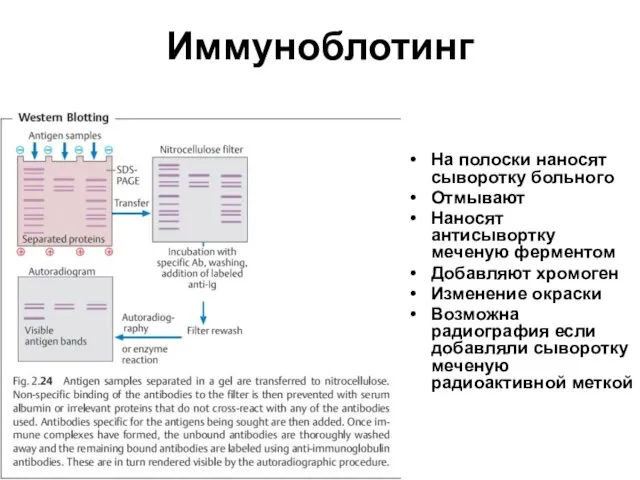 Иммуноблотинг На полоски наносят сыворотку больного Отмывают Наносят антисывортку меченую ферментом Добавляют