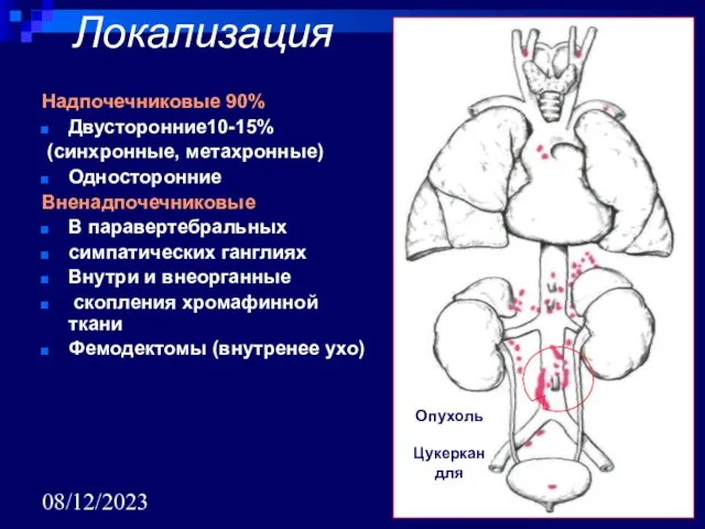 08/12/2023 Локализация Надпочечниковые 90% Двусторонние10-15% (синхронные, метахронные) Односторонние Вненадпочечниковые В паравертебральных симпатических