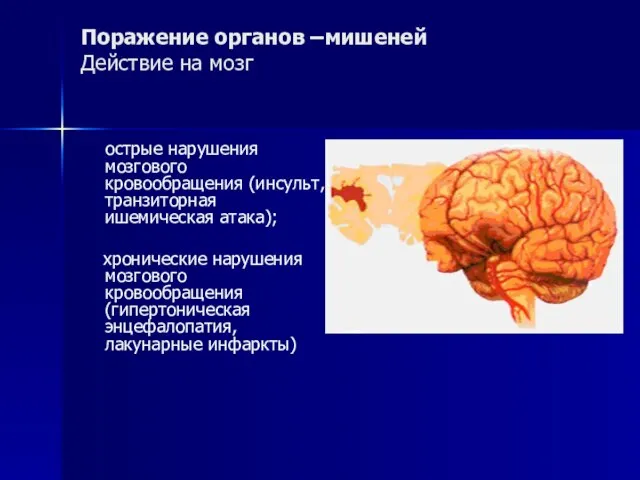 Поражение органов –мишеней Действие на мозг острые нарушения мозгового кровообращения (инсульт, транзиторная