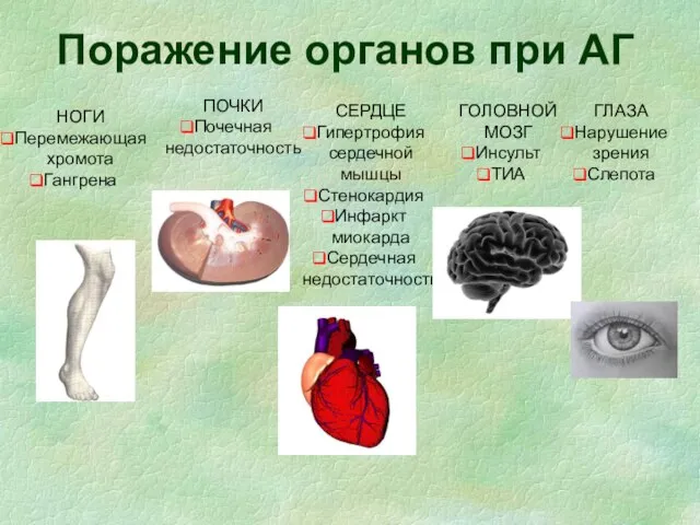 Поражение органов при АГ НОГИ Перемежающая хромота Гангрена ПОЧКИ Почечная недостаточность СЕРДЦЕ