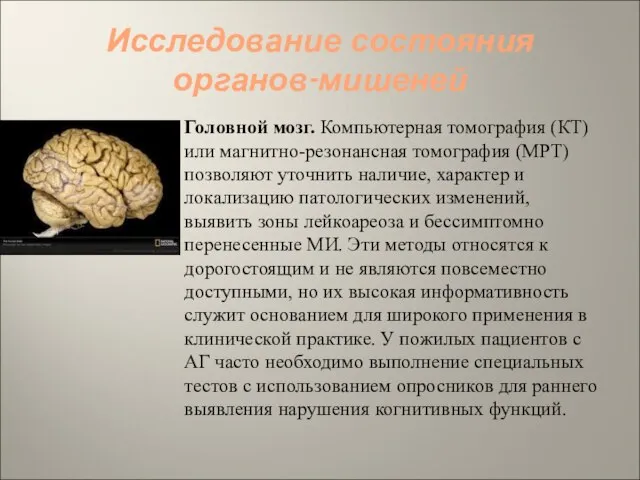 Исследование состояния органов-мишеней Головной мозг. Компьютерная томография (КТ) или магнитно-резонансная томография (МРТ)