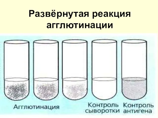 Развёрнутая реакция агглютинации