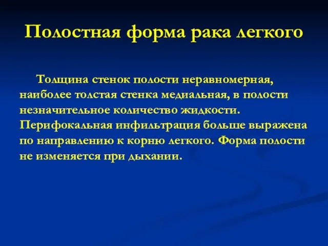 Полостная форма рака легкого Толщина стенок полости неравномерная, наиболее толстая стенка медиальная,