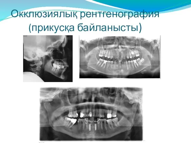 Окклюзиялық рентгенография (прикусқа байланысты) Рентгенография | Стоматология "Leo Dent" leo-dent.ruleo-dent.ru610 × 323Search