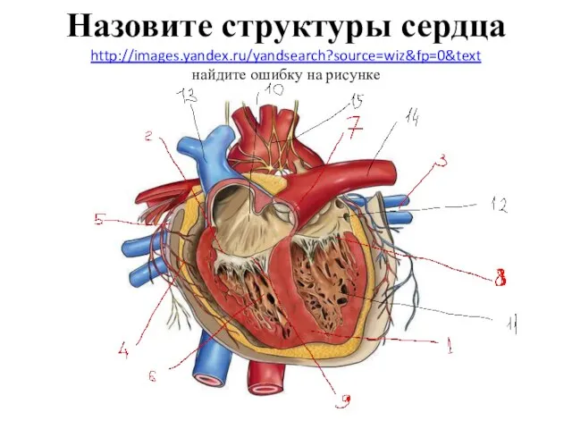 Назовите структуры сердца http://images.yandex.ru/yandsearch?source=wiz&fp=0&text найдите ошибку на рисунке