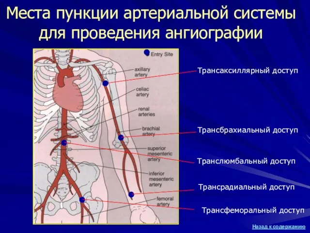 Места пункции артериальной системы для проведения ангиографии ● ● ● ● ●