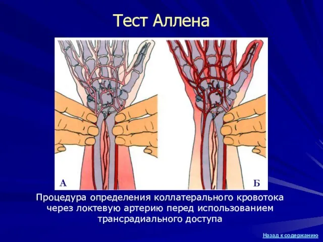 Тест Аллена