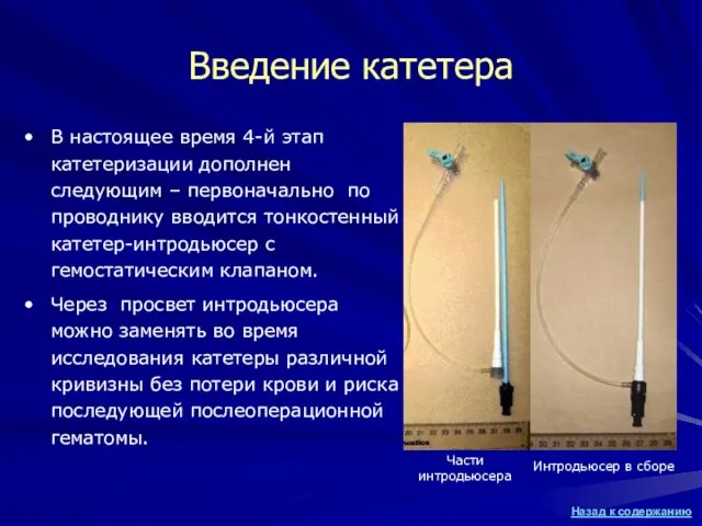 Введение катетера В настоящее время 4-й этап катетеризации дополнен следующим – первоначально