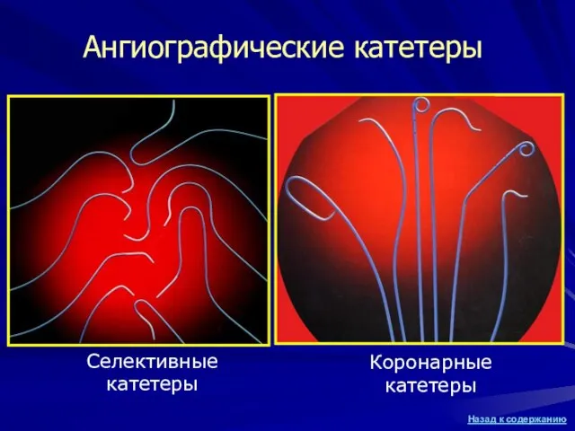 Ангиографические катетеры Селективные катетеры Коронарные катетеры