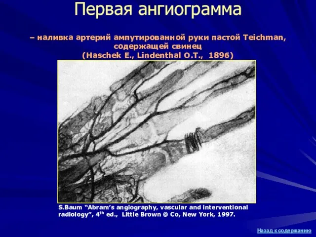 Первая ангиограмма S.Baum “Abram’s angiography, vascular and interventional radiology”, 4th ed., Little