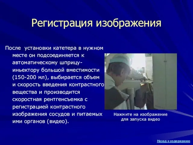 Регистрация изображения После установки катетера в нужном месте он подсоединяется к автоматическому