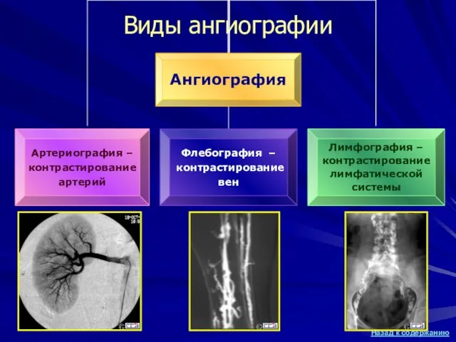 Виды ангиографии