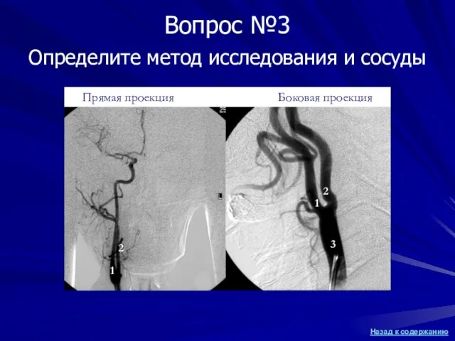 Определите метод исследования и сосуды 1 Вопрос №3