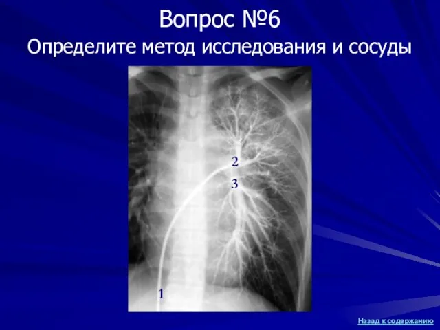 Определите метод исследования и сосуды Вопрос №6