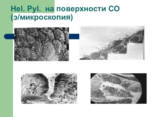 Hel. Pyl. на поверхности СО (э/микроскопия)