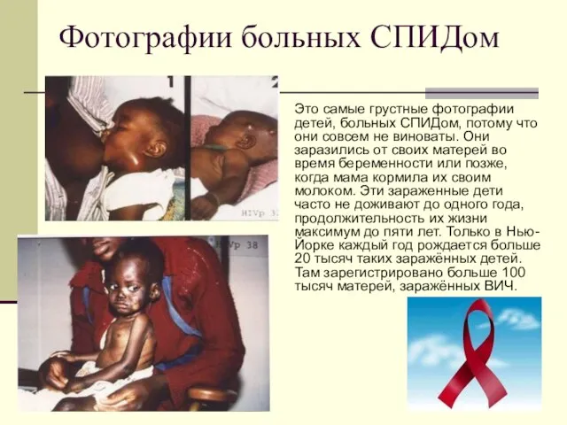 Фотографии больных СПИДом Это самые грустные фотографии детей, больных СПИДом, потому что