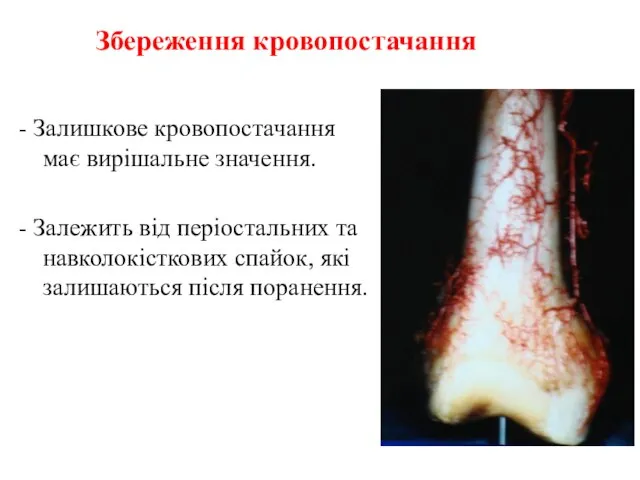 Збереження кровопостачання - Залишкове кровопостачання має вирішальне значення. - Залежить від періостальних