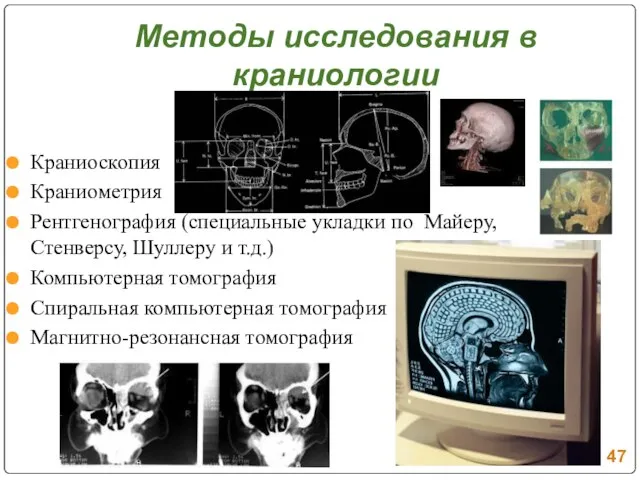 Методы исследования в краниологии Краниоскопия Краниометрия Рентгенография (специальные укладки по Майеру, Стенверсу,