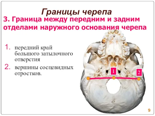 передний край большого затылочного отверстия вершины сосцевидных отростков. Границы черепа 1 2