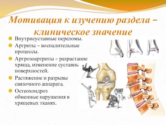 Мотивация к изучению раздела – клиническое значение Внутрисуставные переломы. Артриты – воспалительные