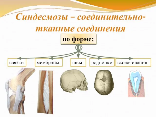 Синдесмозы – соединительно- тканные соединения по форме: мембраны связки швы роднички вколачивания