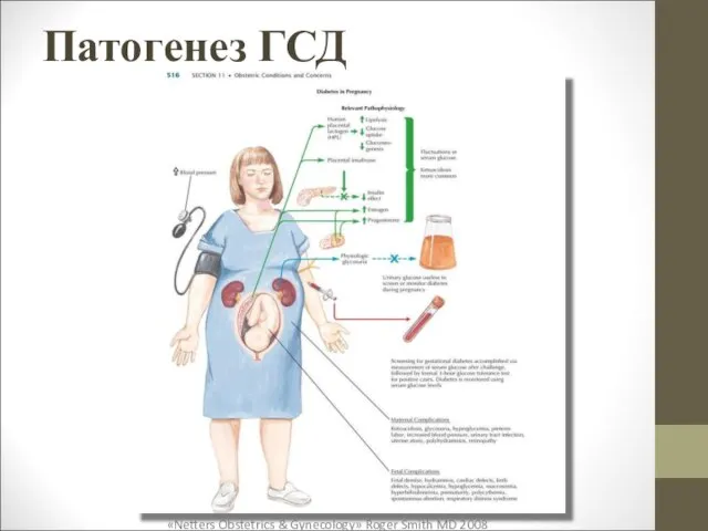 Патогенез ГСД «Netters Obstetrics & Gynecology» Roger Smith MD 2008